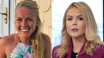 karoline-leavitts-nose-could-be-a-result-of-plastic-surgery-or-contouring-1739812726.sm.webp